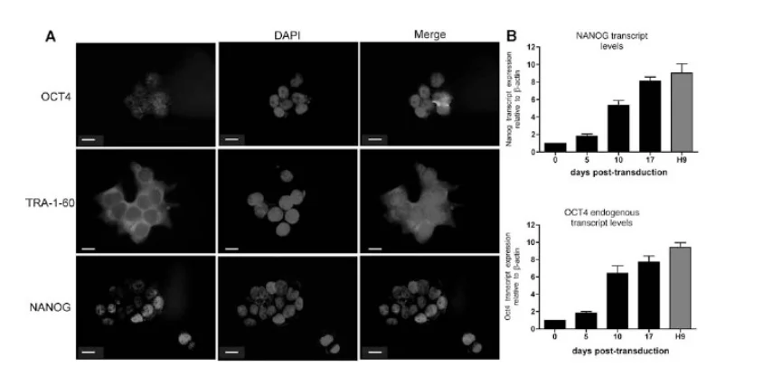 Thomas Ichim: Making iPSC Cells from Menstrual Blood Stem Cells 1 Thomas Ichim: Making iPSC Cells from Menstrual Blood Stem Cells