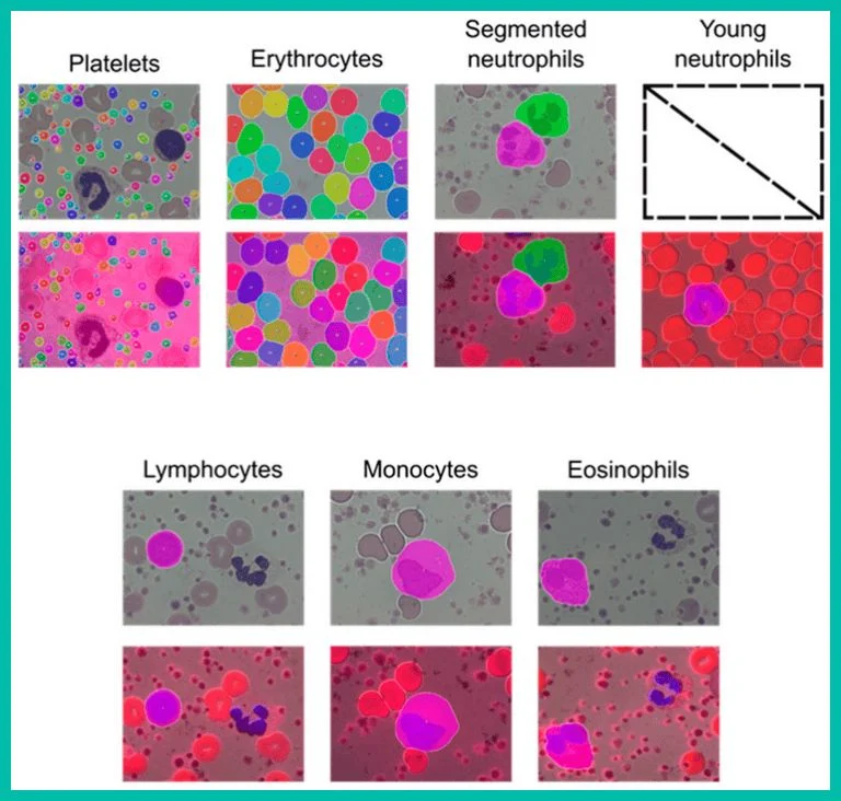 Moustafa Abdou: Artificial Intelligence in Hematology