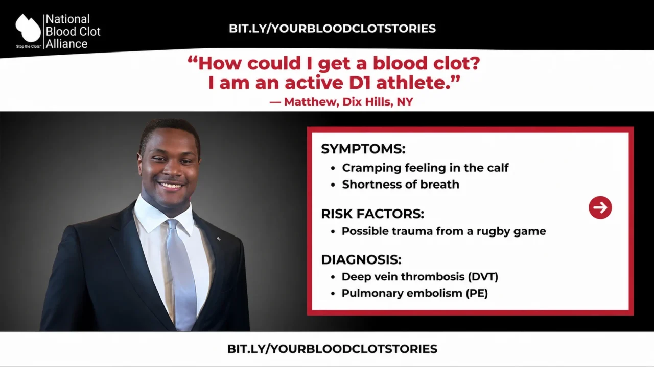 Blood Clots Can Happen to Anyone – NBCA
