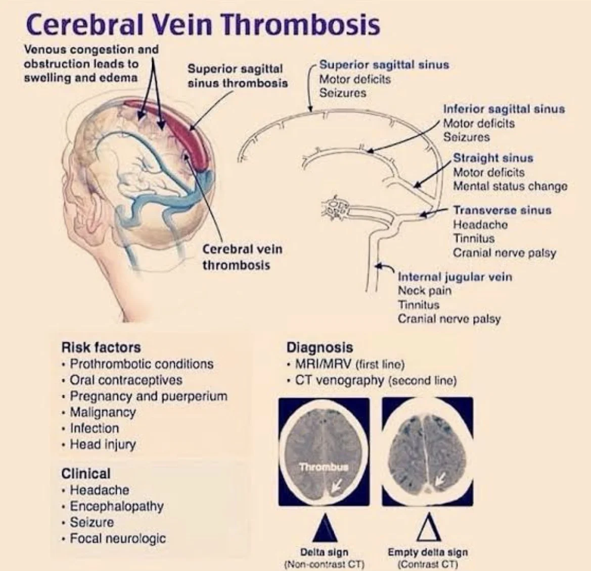 Sthanu Subramanian: CVST as The 'Great Masquerader' with Normal Initial CT