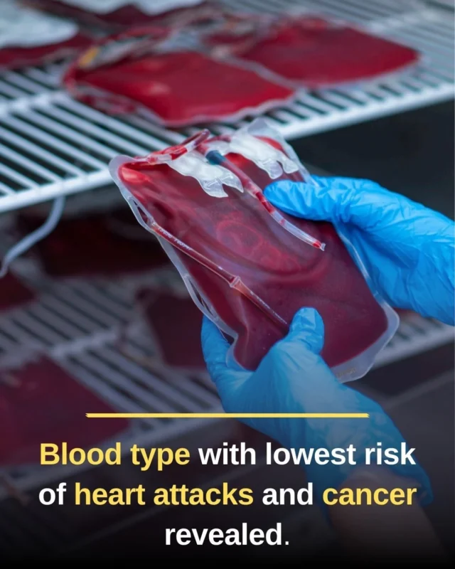 Francesco Lo Monaco: Blood Type and Heart Risk - Small Differences, Bigger Role of Lifestyle