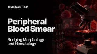 Peripheral Blood Smear (PBS) Under the Microscope: Bridging Morphology and Hematology