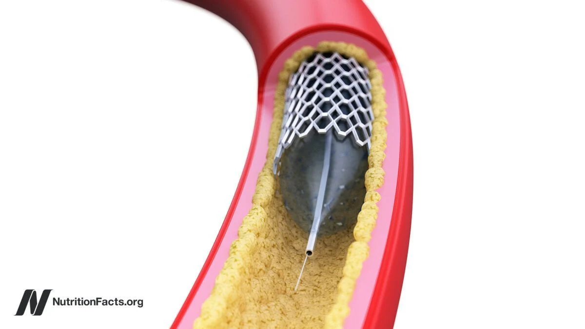 Michael Greger: Most Heart Attacks Are Triggered by Non-Obstructive Plaques