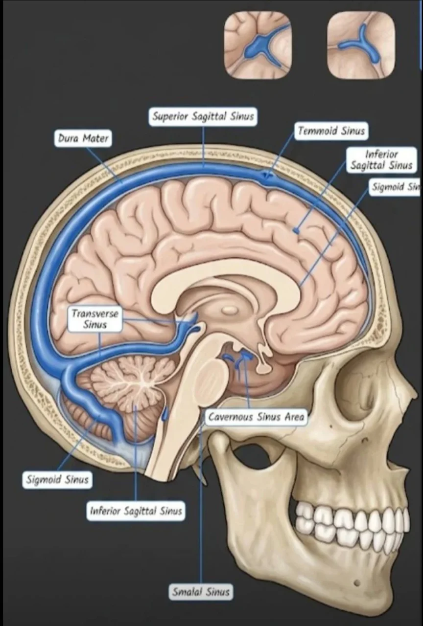 Deva Nanda TK: A Practical Overview of Dural Sinuses and The Venous Drainage of the Brain
