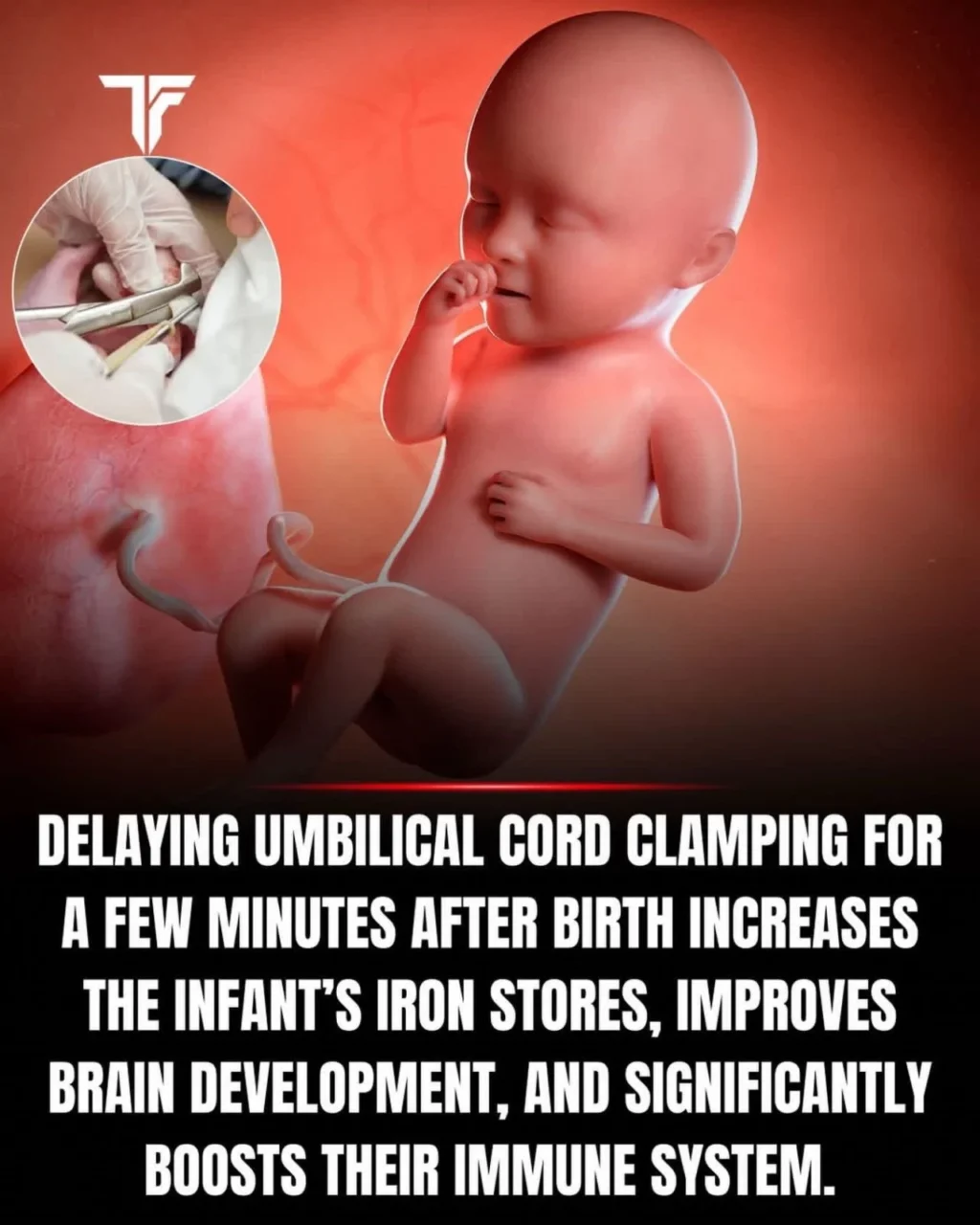 Mahesan Subramaniam: Why Delayed Cord Clamping Benefits Newborn Health