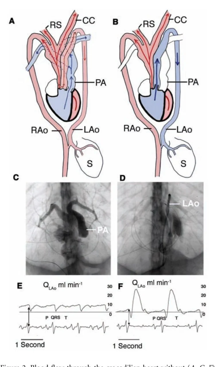 Mohamed Bastawy: Evaluating Physiologic Significance in Coronary Artery Fistula