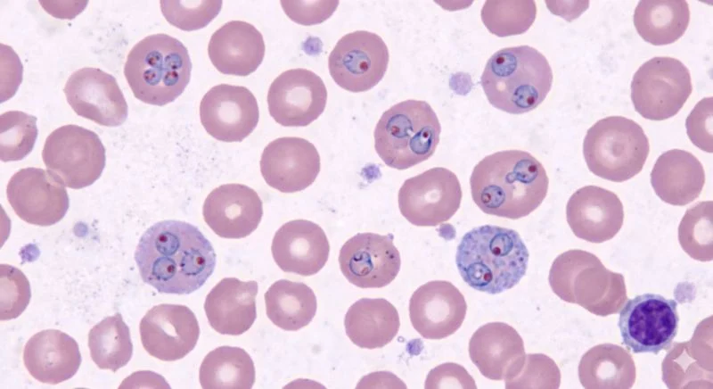Caitlin Raymond: How STOP-BABESIOSIS Just Rewrote 40 Years of Practice 1 Caitlin Raymond