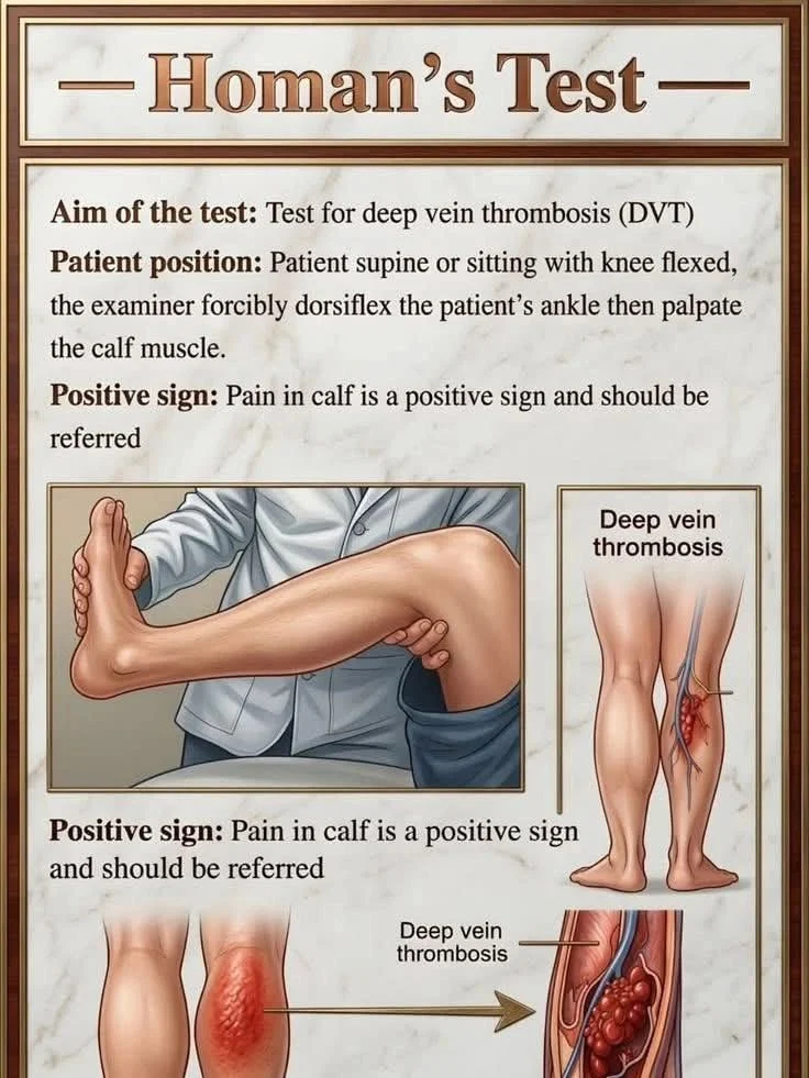 Nigusu Tesema: What Is Deep Vein Thrombosis and Why Does It Matter After Surgery? 1 Nigusu Tesema: What Is Deep Vein Thrombosis and Why Does It Matter After Surgery?