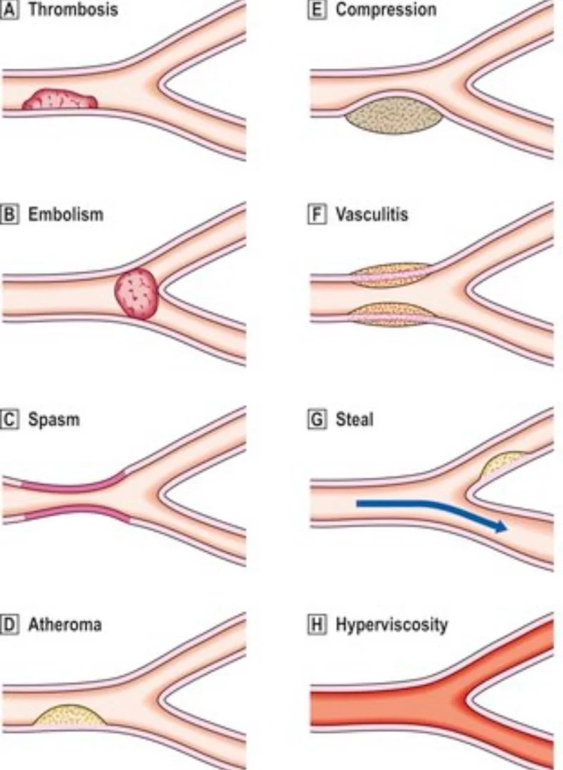 Zain Khalpey: In Cardiovascular Medicine Flow Is Everything