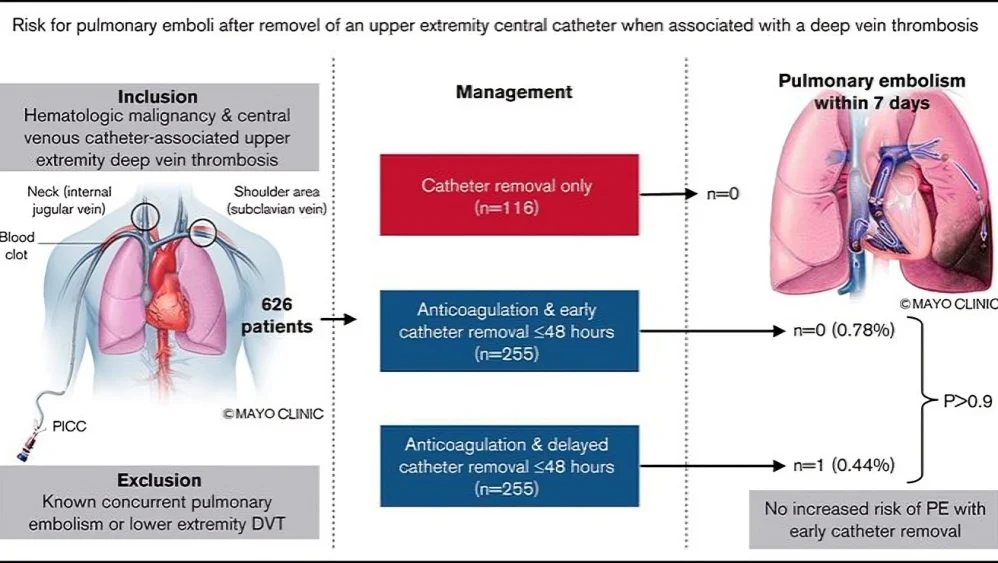 Chokri Ben Lamine: CVC-Associated UE-DVT and Catheter Removal