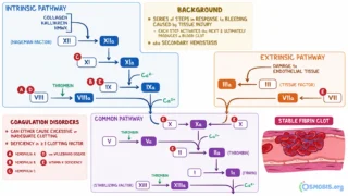 Papa Heme։ Causes of Isolated Prolonged aPTT Without Bleeding
