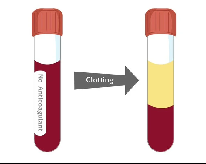 Haji Siyamuddin Ansari: The Key Difference Between Plasma and Serum 1 Haji Siyamuddin Ansari: The Key Difference Between Plasma and Serum