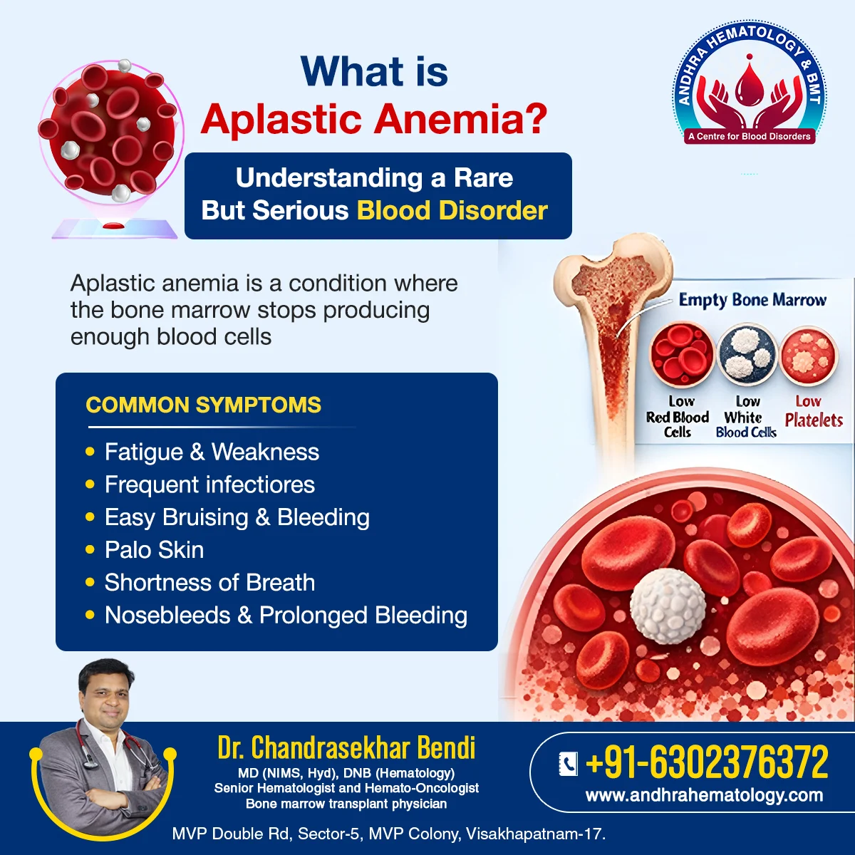 Chandrasekhar Bendi: Aplastic Anemia - Understanding a Rare but Serious Blood Disorder