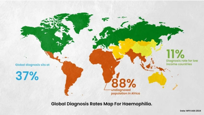 Masoabi Sefojane: In Africa 88% of Hemophilia Remains Undiagnosed