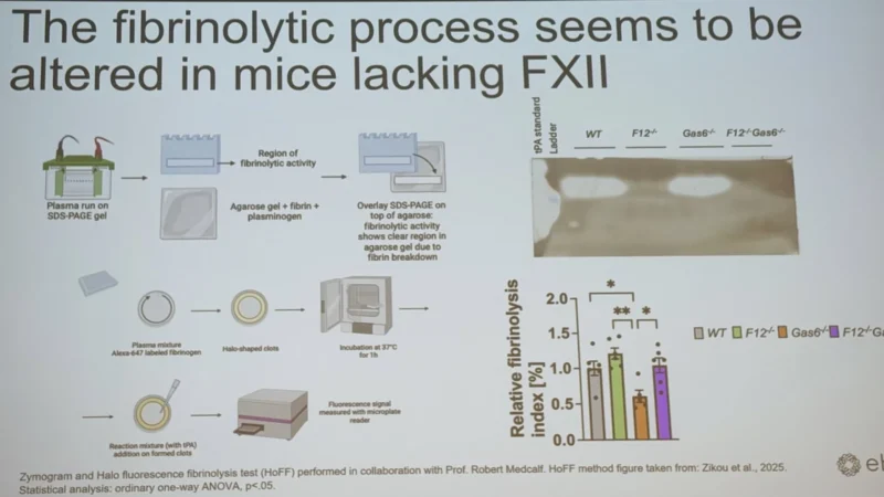 Wolfgang Miesbach: How a ‘Non‑Bleeding’ Factor XII Shapes Thrombosis and Fibrinolysis
