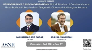 Asif Dogar: My ASNR Webinar on Cerebral Venous Thrombosis Is Now Live