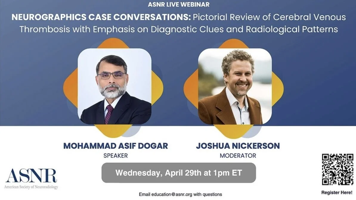 Asif Dogar: My ASNR Webinar on Cerebral Venous Thrombosis Is Now Live