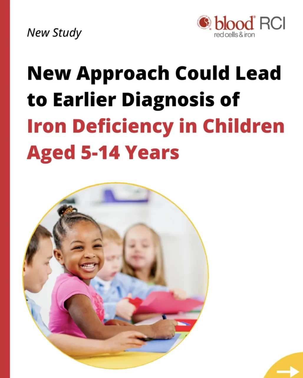 New Approach Could Lead to Earlier Diagnosis of Iron Deficiency in Children - American Society of Hematology