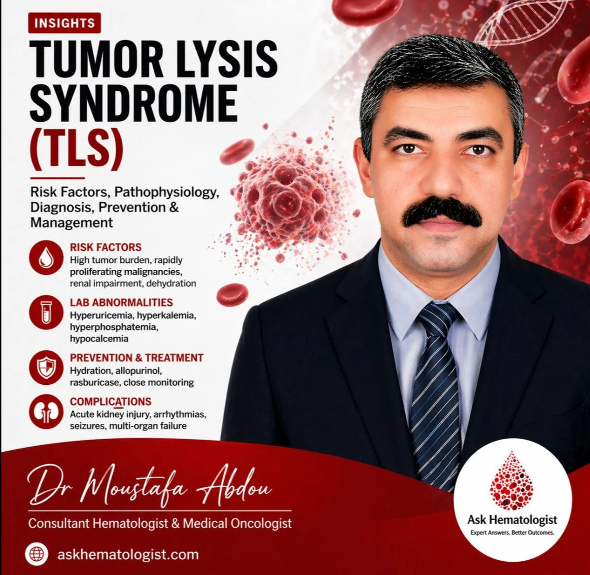 Moustafa Abdou: Tumor Lysis Syndrome Is a Preventable but Life-Threatening Oncologic Emergency