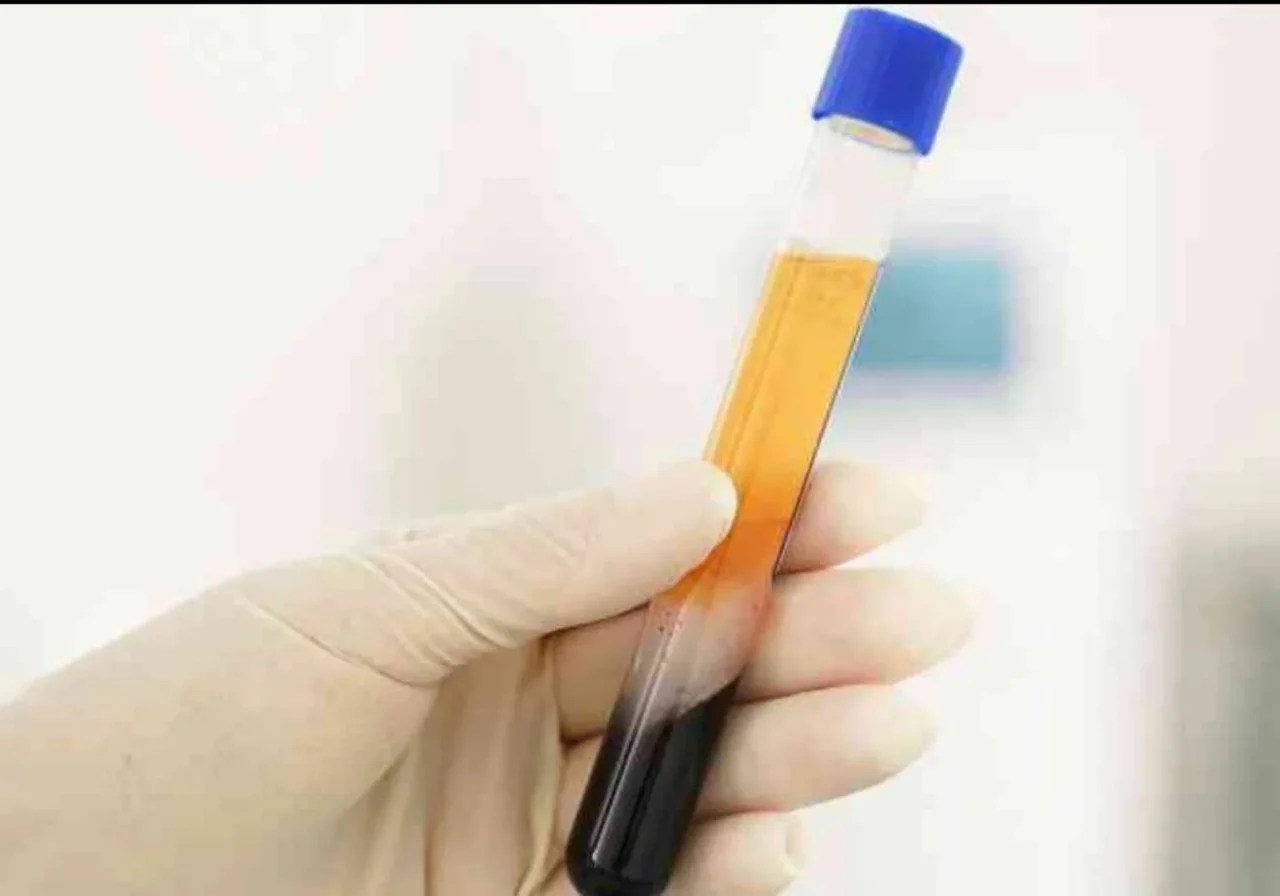Leslie B. Vidal: PRP in Sports Medicine