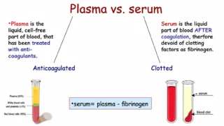 Haji Siyamuddin Ansari: The Key Difference Between Plasma and Serum
