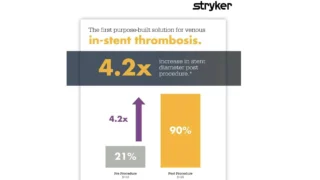 Surveillance Identifies Thrombosis – RevCore Restores Flow - Stryker Peripheral Vascular