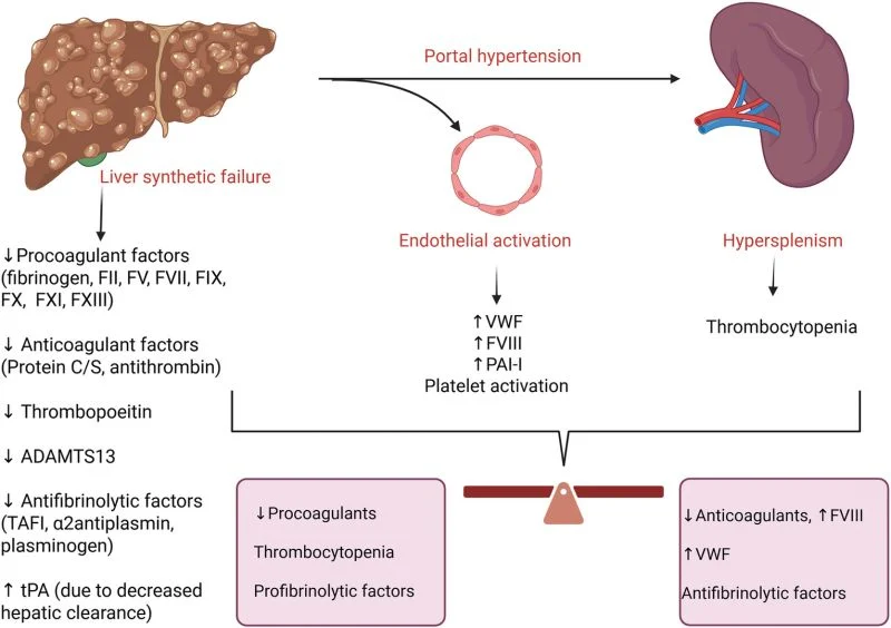 Rob Mac Sweeney: Prevention and Treatment of Thrombosis in Patients With Decompensated Cirrhosis