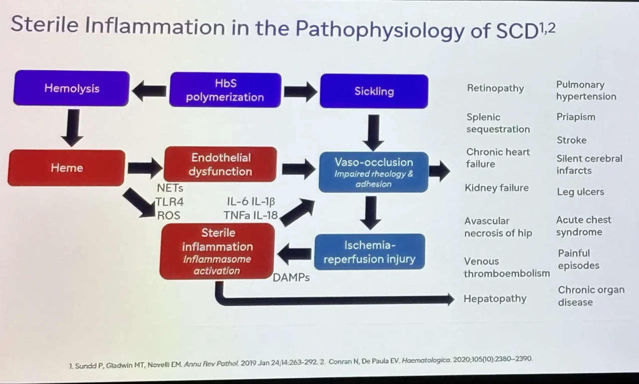 Miguel Gómez Álvarez: Reviewing Inflammation, Transplantation, and Gene Therapy in Hemoglobinopathies 1 Miguel Gómez Álvarez