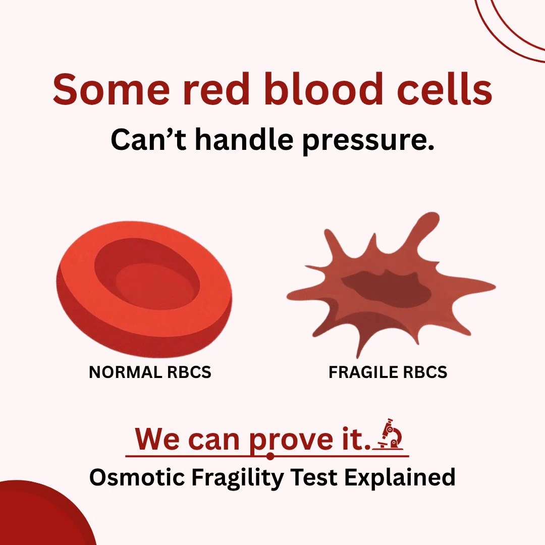 Mariam Swidan: Some Red Blood Cells Can’t Handle Pressure