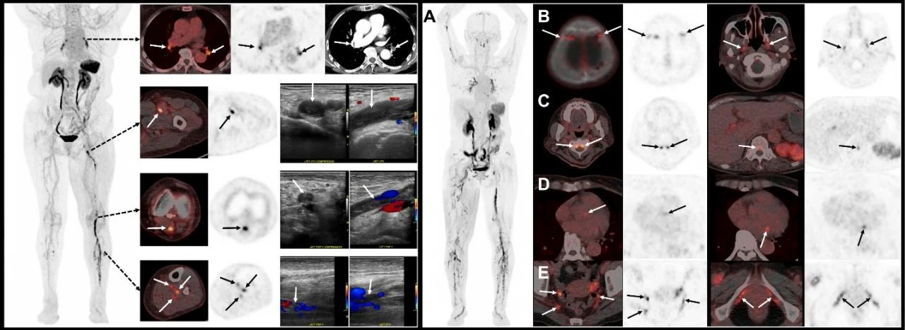 Brian Casey: SNMMI26 Image of the Year Highlights Novel DVT Imaging Technique 1 Brian Casey: SNMMI26 Image of the Year Highlights Novel DVT Imaging Technique
