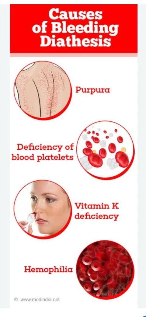 The Science Behind Bleeding Diathesis and Coagulation Defects - ICHCC