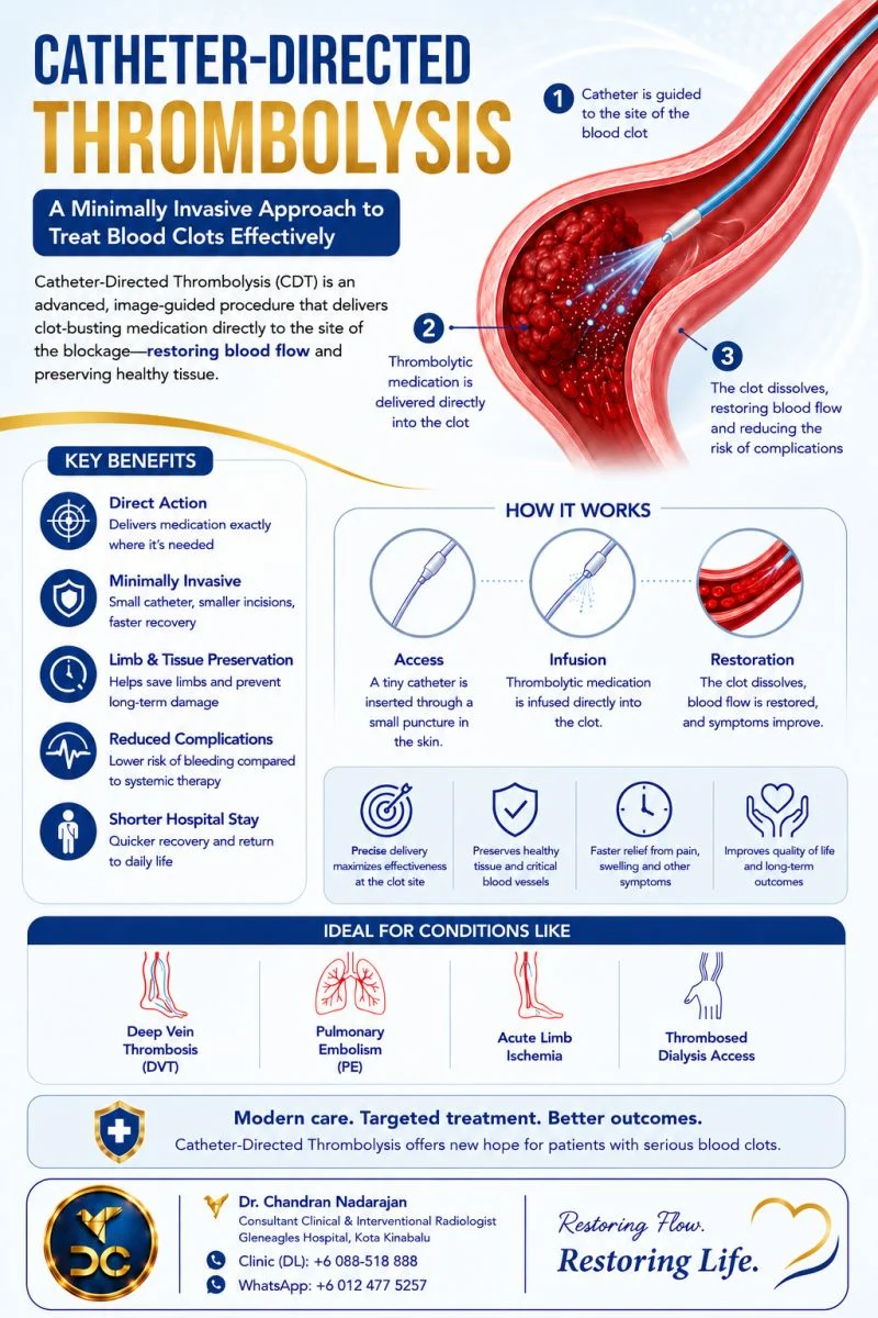 Chandran Nadarajan: Targeted Endovascular Thrombolysis Offers Organ-Saving Benefits in Vascular Occlusions 1 Chandran Nadarajan: Targeted Endovascular Thrombolysis Offers Organ-Saving Benefits in Vascular Occlusions