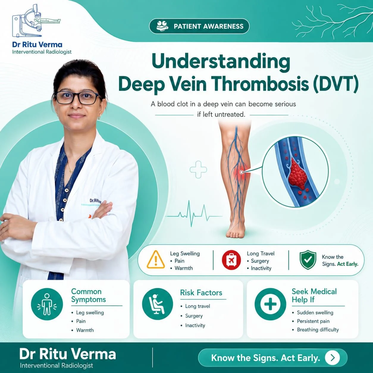Ritu Verma: Recognizing Deep Vein Thrombosis Before Complications Arise 1 Ritu Verma: Recognizing Deep Vein Thrombosis Before Complications Arise