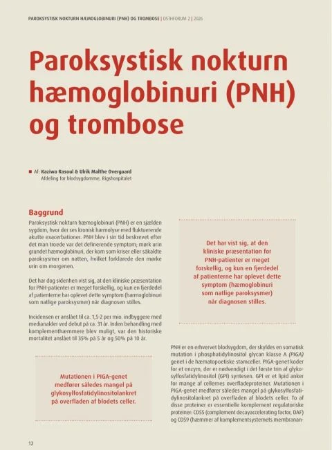 Kaziwa Rasoul: Understanding Thrombosis in PNH