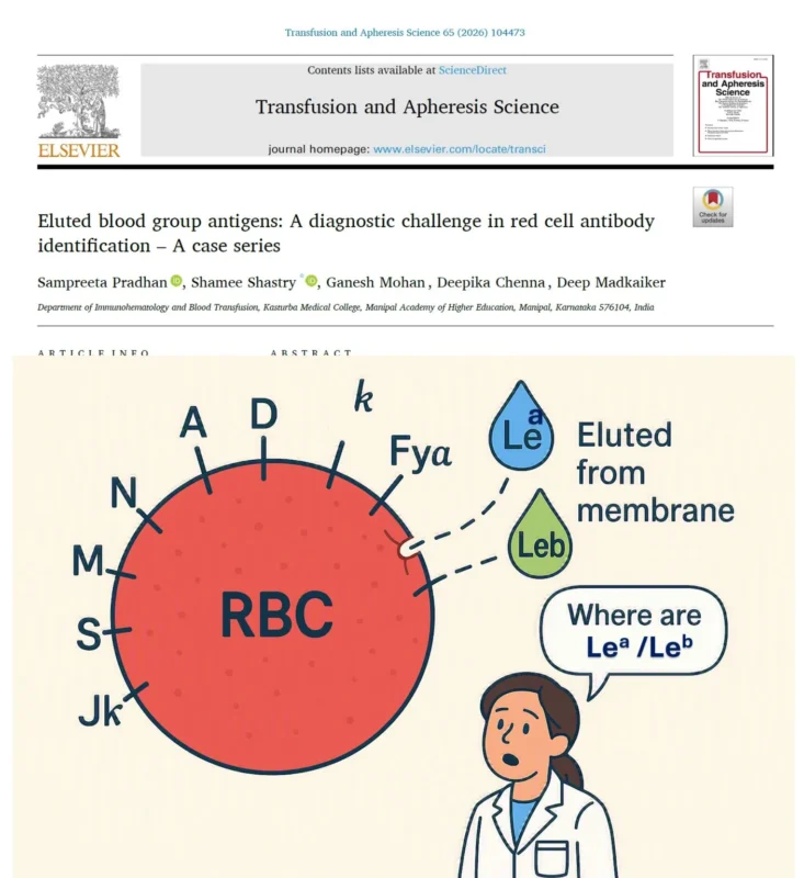 Shamee Shastry: Lewis Antigen Elution and the Challenge of False-Negative Reactions 1 Shamee Shastry: Lewis Antigen Elution and the Challenge of False-Negative Reactions
