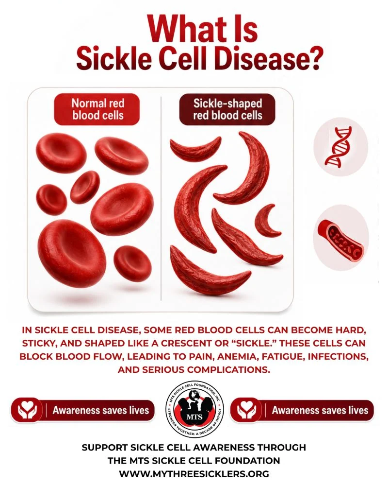 Mapillar Dahn: Empowering Sickle Cell Warriors Through Awareness and Support
