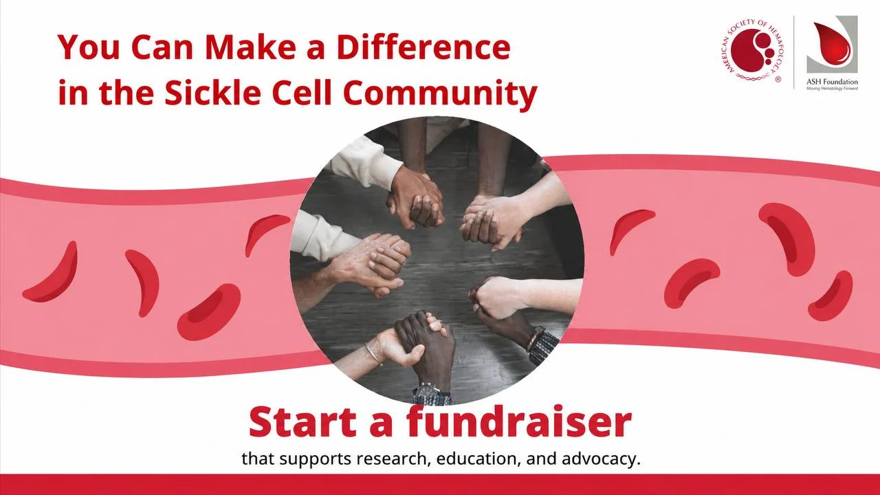 Advancing Sickle Cell Disease Research Through Community Support – ASH