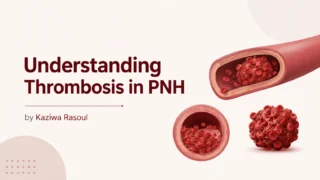 Kaziwa Rasoul: Understanding Thrombosis in PNH