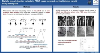 Recurrent Cervical Internal Carotid Vasospasm Linked to Autosomal Recessive PTGIS Defect - International Journal of Stroke
