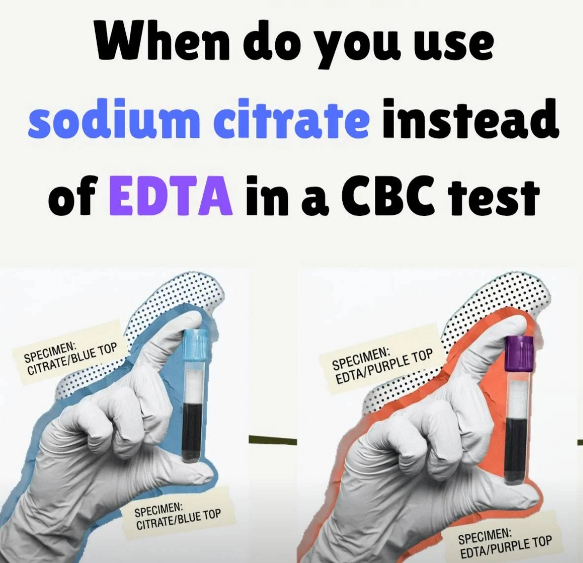 Razan Suliman: When do we use sodium citrate instead of EDTA for a CBC?