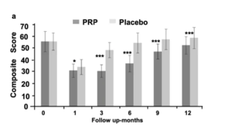 Severiano Dos Anjos Vilaboa: The Search for the Optimal PRP Strategy