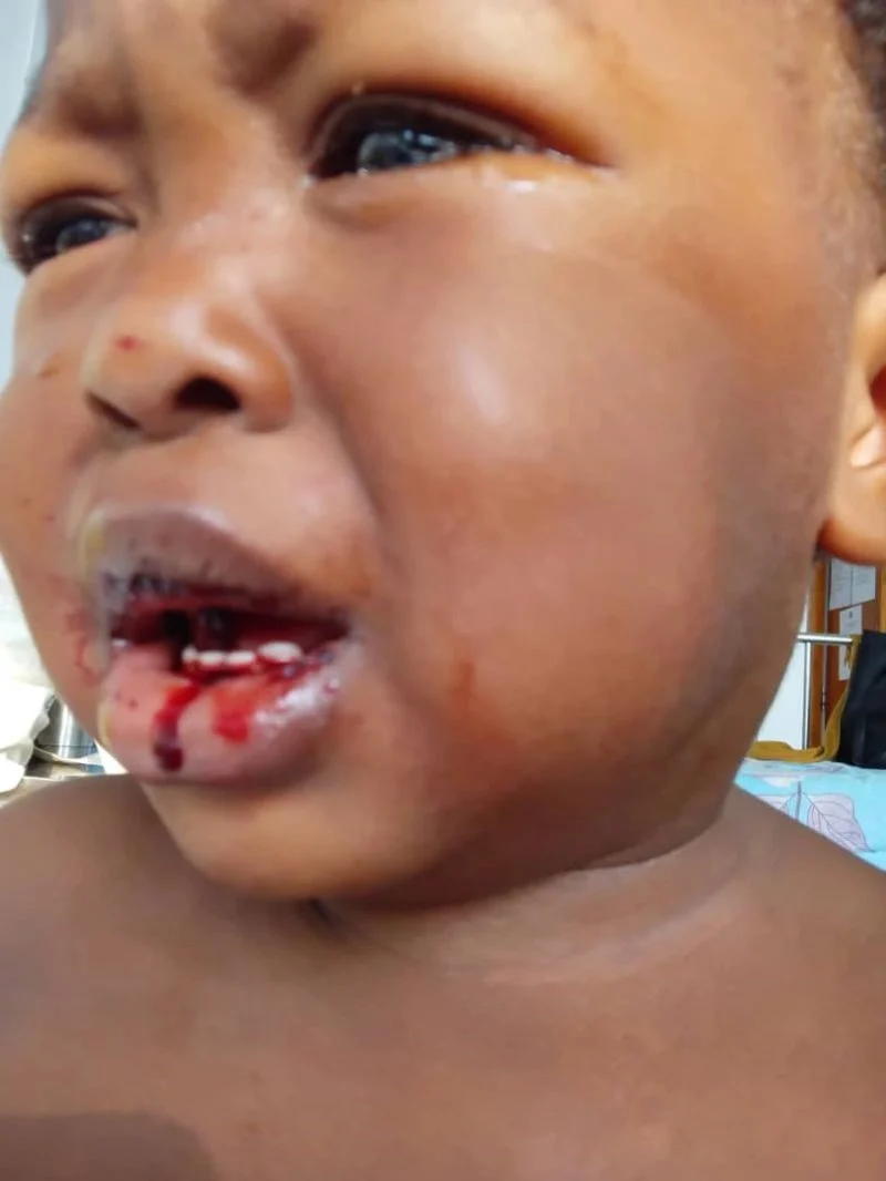 Cedric Stephane Fosso: Every Drop of Blood Matters - A Child's Silent Cry for Hemophilia Awareness 