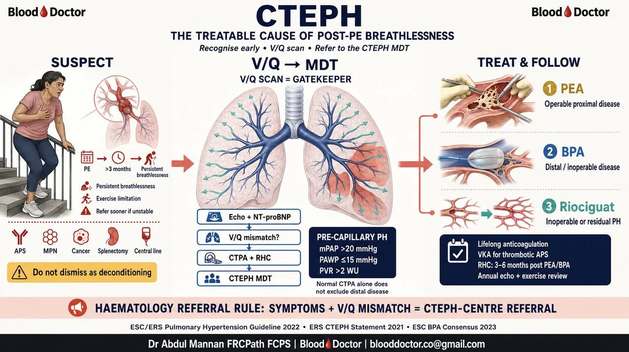 Abdul Mannan: CTEPH - The Treatable Cause of Post-PE Breathlessness
