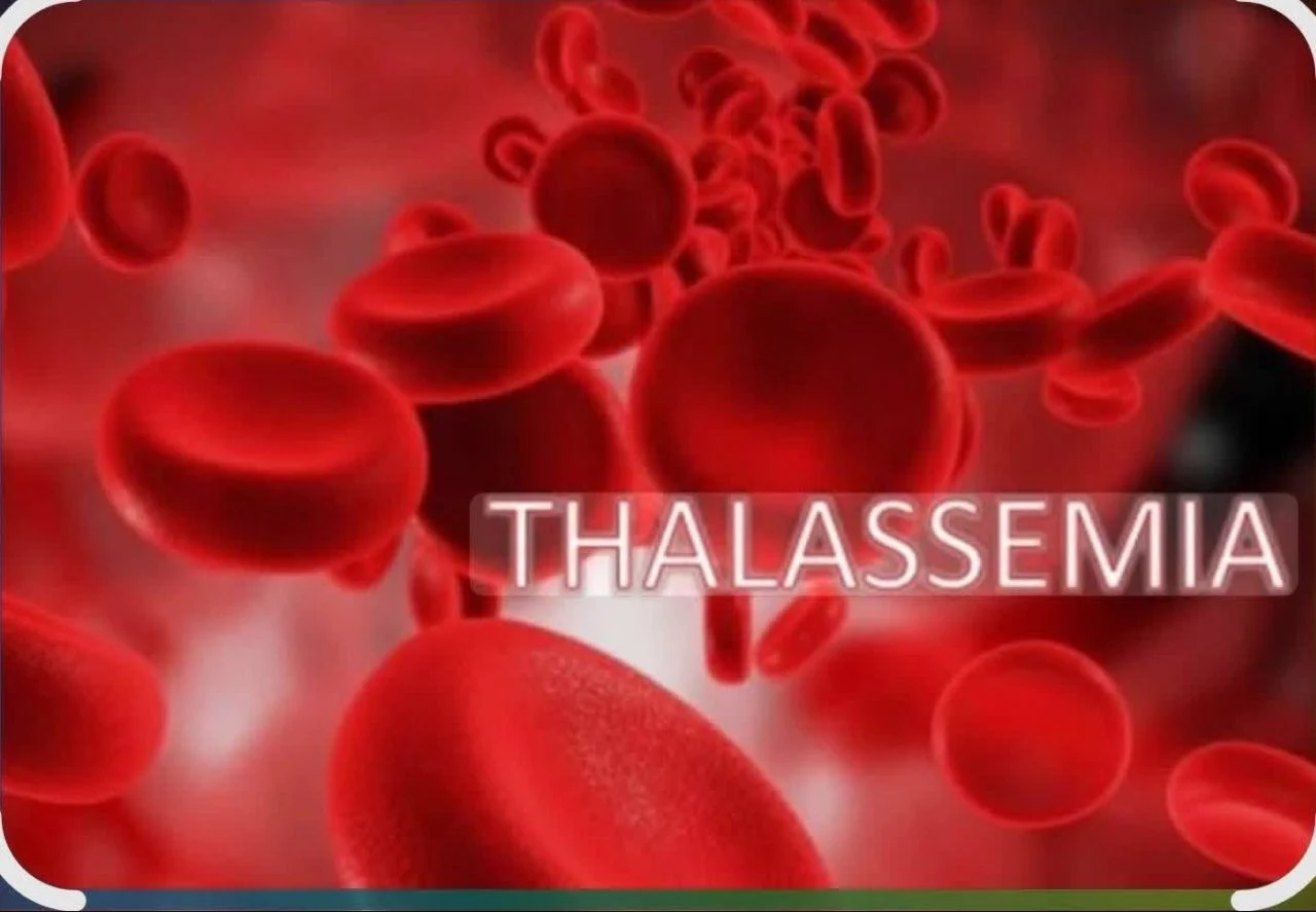 Saoud Hassan: A Comprehensive Guide to Beta Thalassemia 1 Saoud Hassan: A Comprehensive Guide to Beta Thalassemia