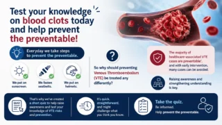 Karen Dorsett: A Quick Quiz That Could Change How You Think About Blood Clots