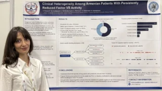 Gohar Tonakanyan: Presenting Armenian Factor VII Research at ISTH 2026