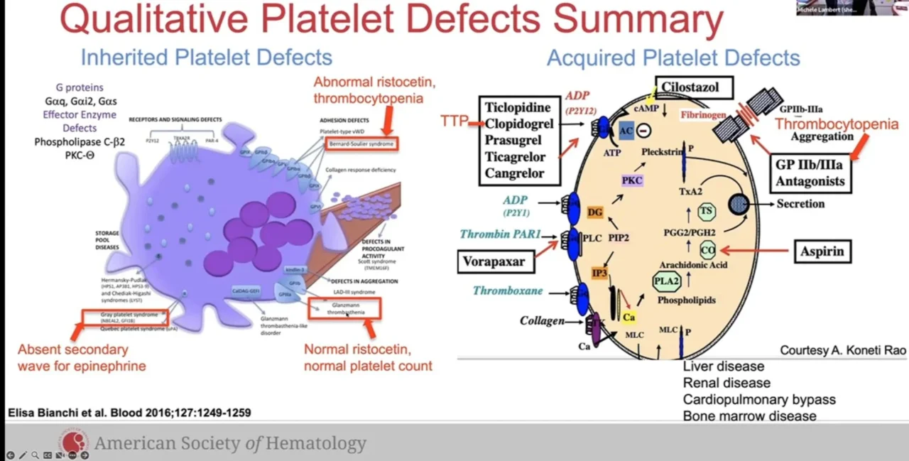 Ahmed Kotb: Exploring Qualitative Platelet Defects 1 Ahmed Kotb