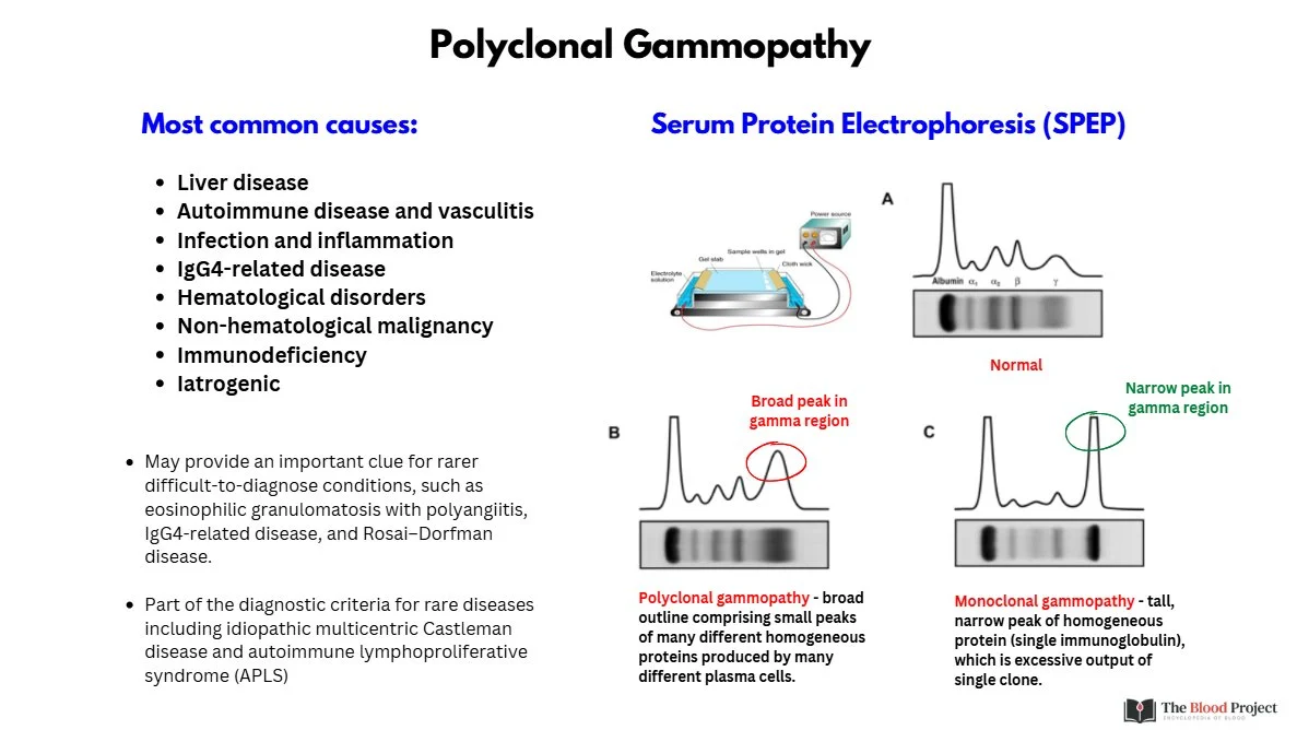 William Aird: Interpreting Polyclonal Gammopathy