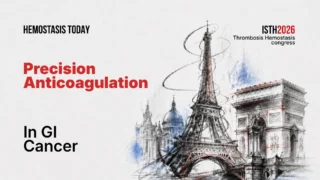 Reduced-Dose DOACs in GI Malignancies: Toward Personalized Anticoagulation