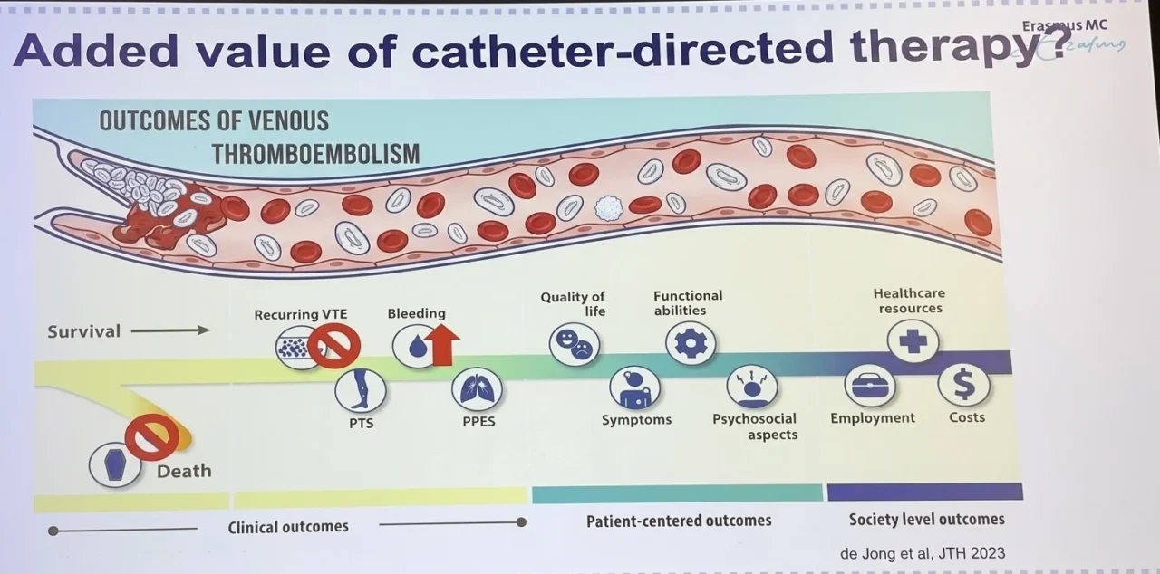 Acute DVT Management and the Role of Interventions Beyond Anticoagulation: Insights From ISTH 2026